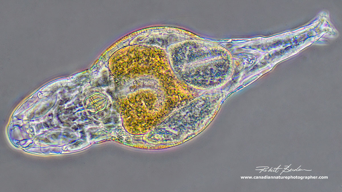 Bedelloid rotifer photographed with positive phase contrast by Robert Berdan ©