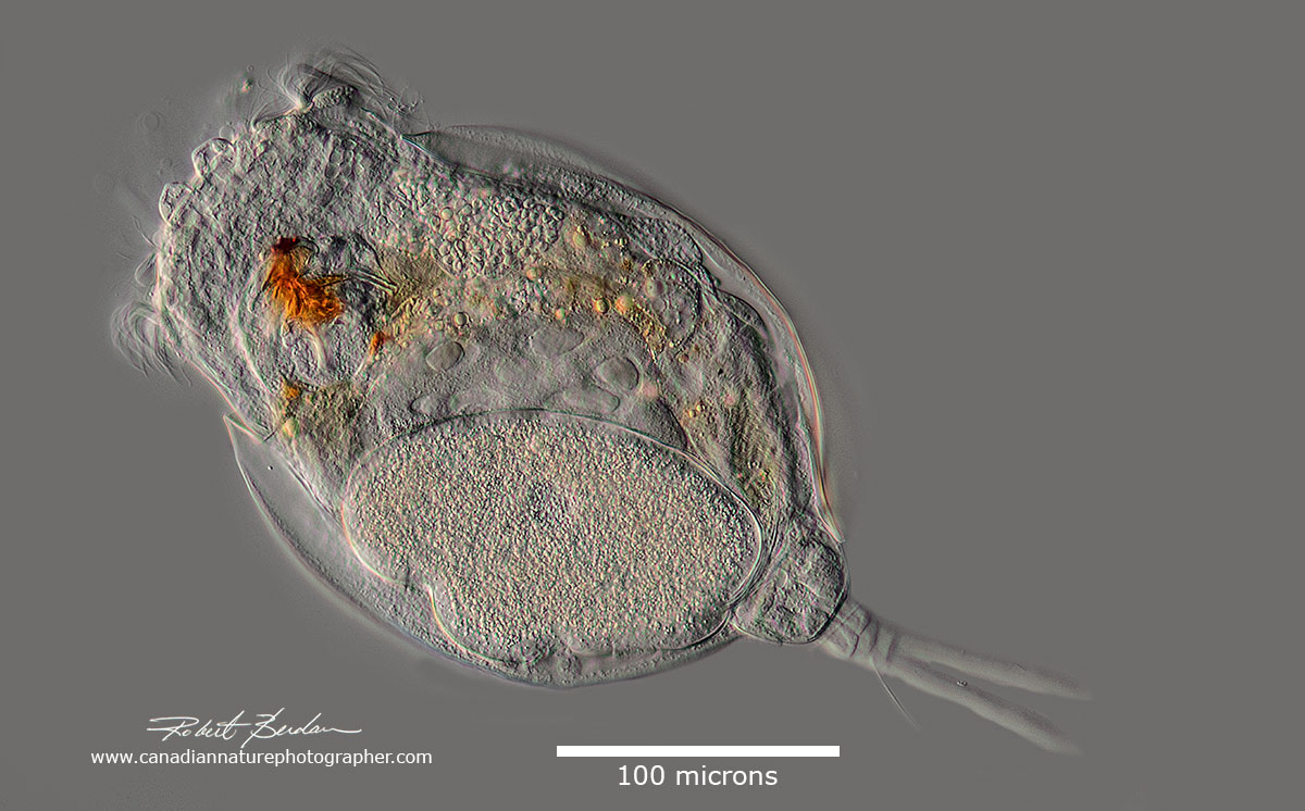 Rotifer Under A Microscope