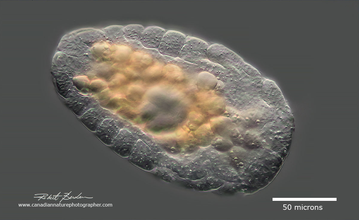 Rotifer cyst, tun or xerosome by Robert Berdan ©