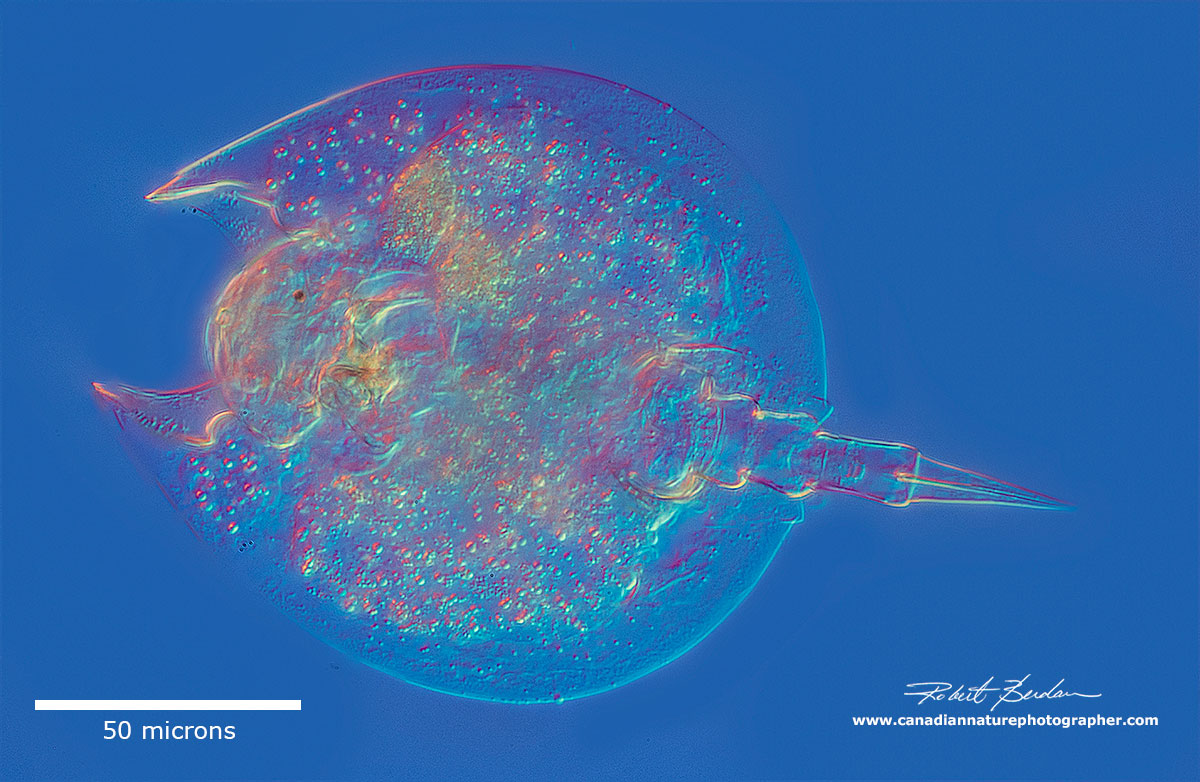 Lepadella sp of rotifer by Robert Berdan ©