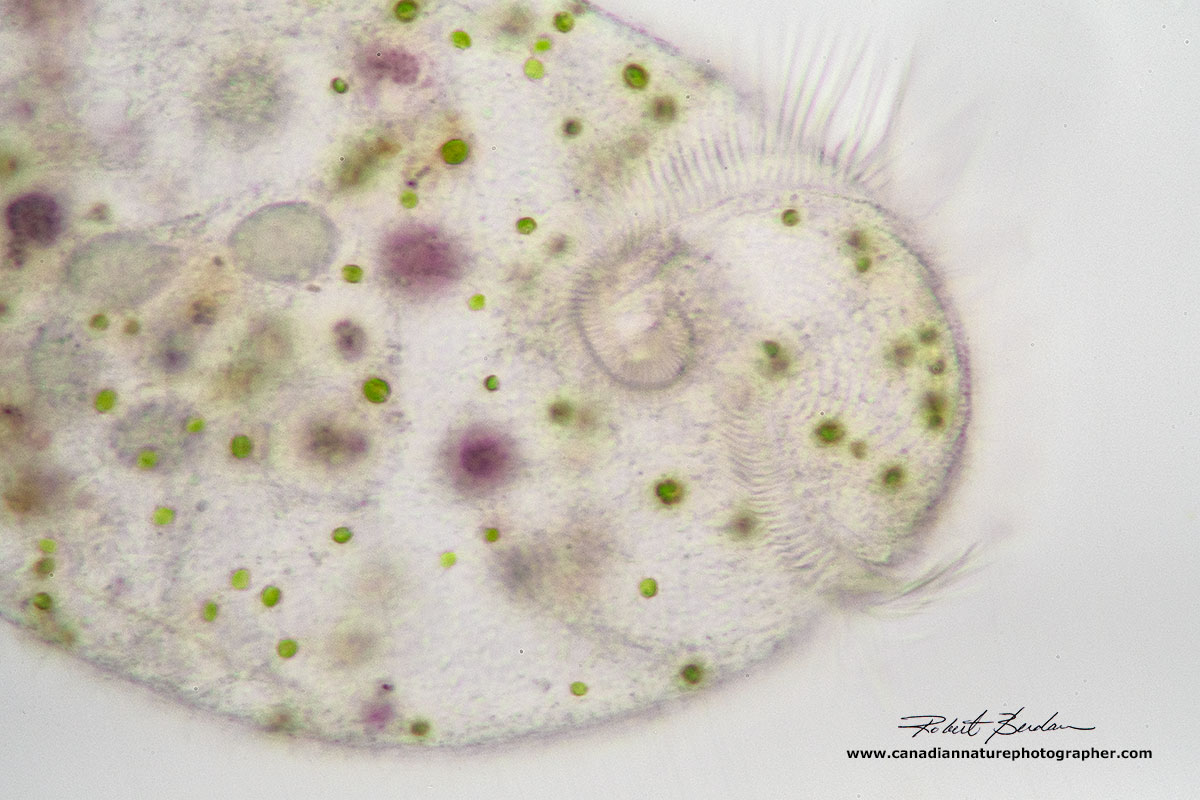 Brightfield microscopy of Stentor showing green symbiotic algae by Robert Berdan ©