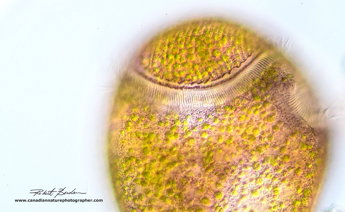 Stentor amethystinus in bright field microscopy by Robert Berdan ©