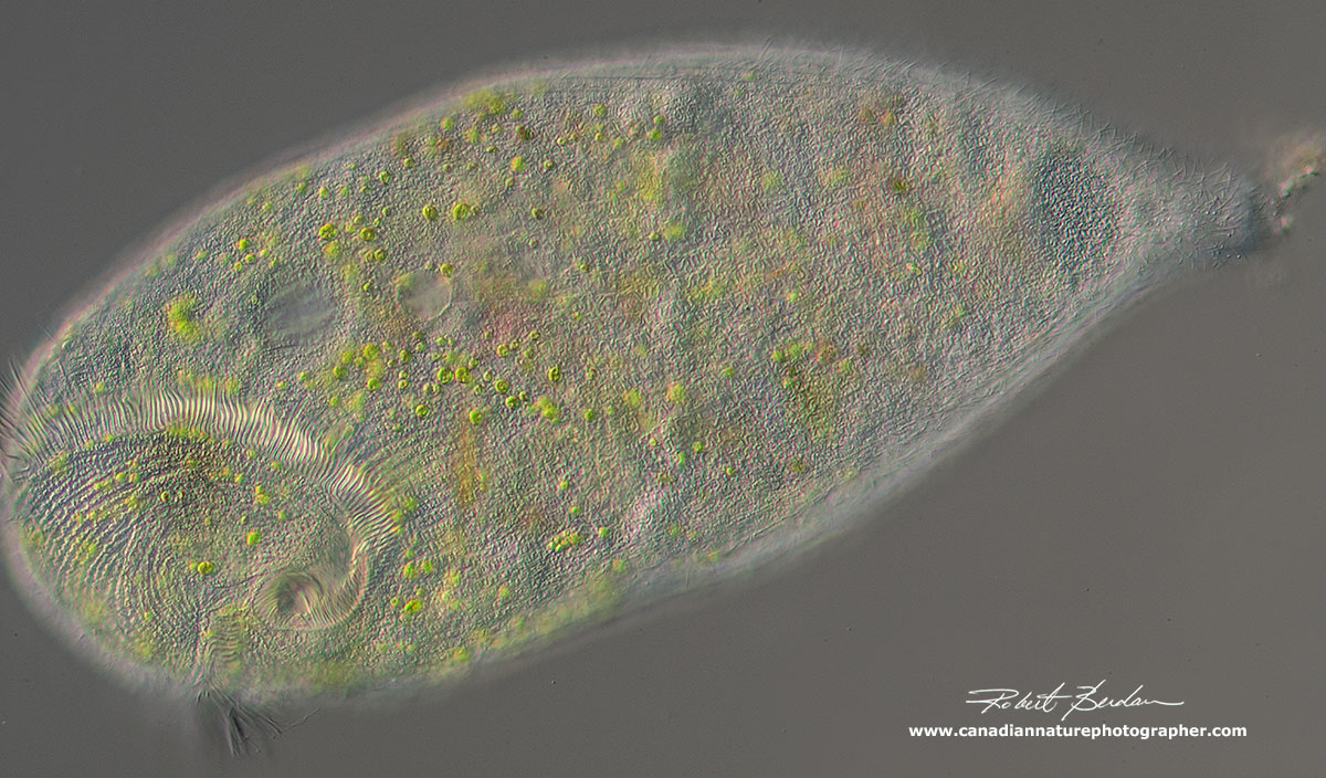Stentor sp with endosymbiotic algae - DIC microscopy 100X by Robert Berdan ©