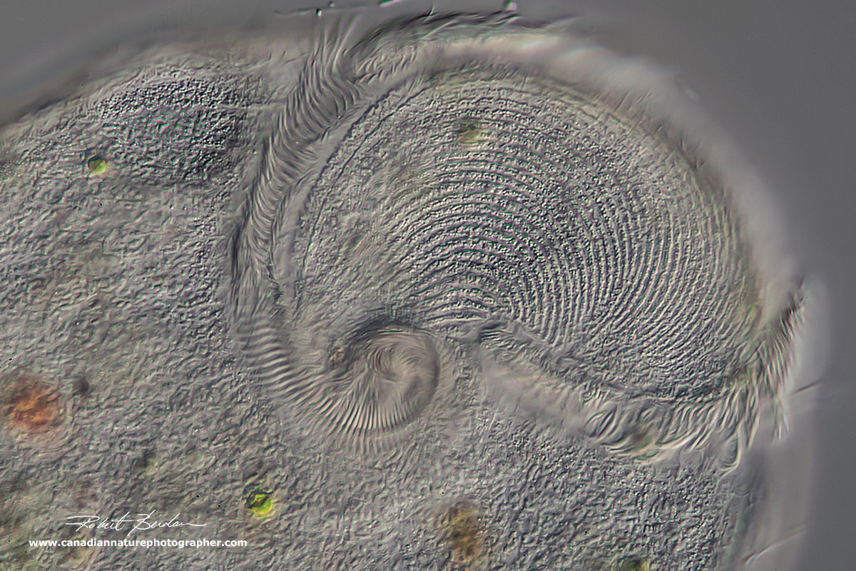 DIC microscope image of Stentor 400X by Robert Berdan ©