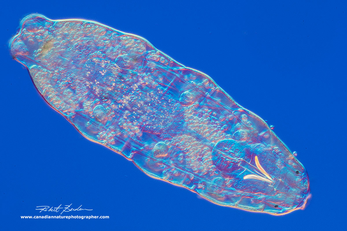 Macrobiotus hufelandi viewed by DIC microscopy by Robert Berdan ©