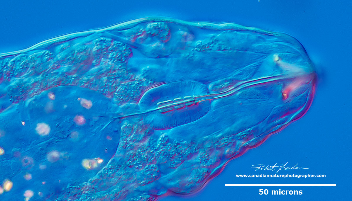 Diphascon species of Tardigrade DIC microscopy showing Buccal Pharyngeal apparatus with three macroplacoids by Robert Berdan DIC microscopy