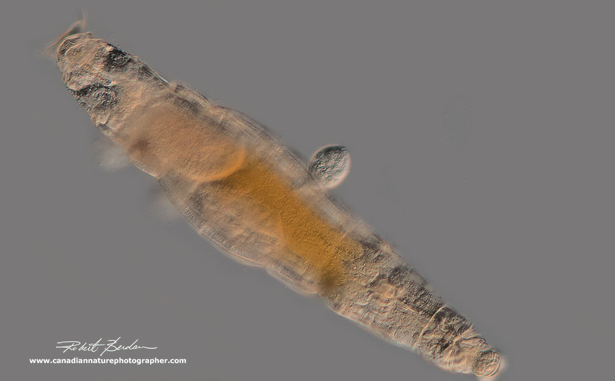 Rotifer with Protozoa Pyxidium tardigradum attached 200X DIC microscopy by Robert Berdan ©