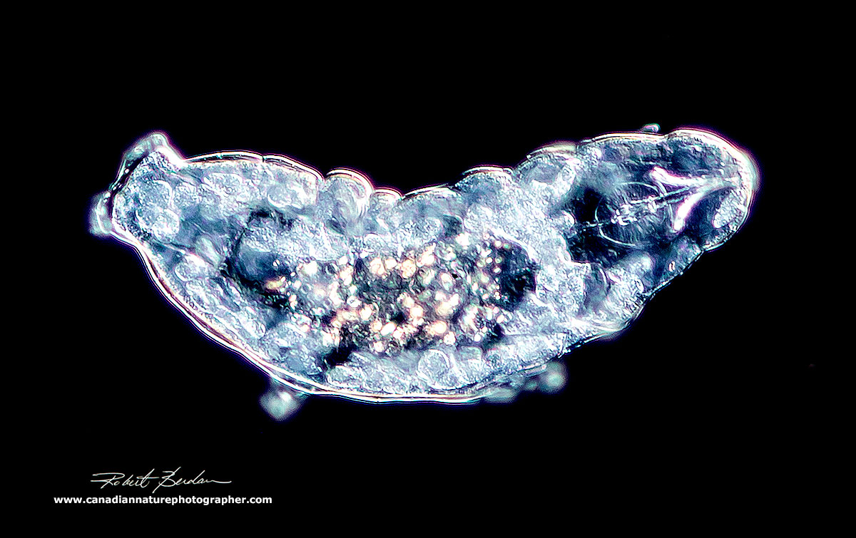 Water bear 200X Darkfield microscopy -Zeiss Axioscope  by Robert Berdan ©