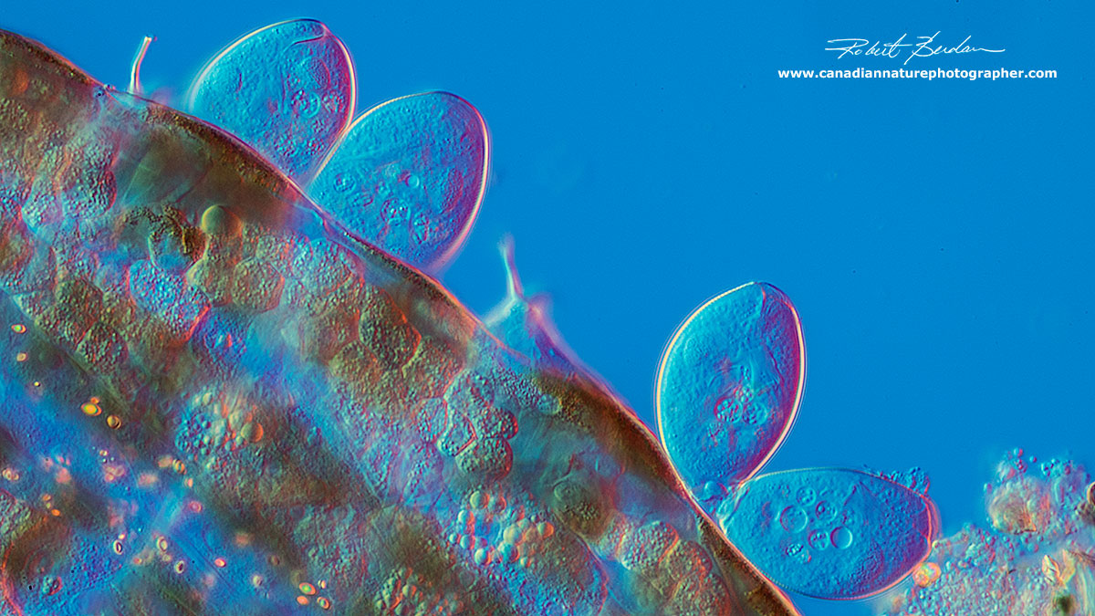 Closeup of the Protozoa Pyxidium tardigradum showing ciliates attached to the Tardigrade cuticle by Robert Berdan ©