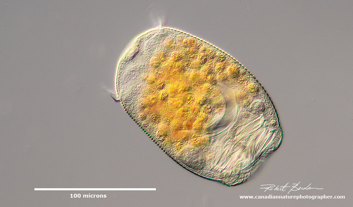 This is the swarmer (telotroch) phase of a peritrich ciliate - probably Vorticella by Robert Berdan ©
