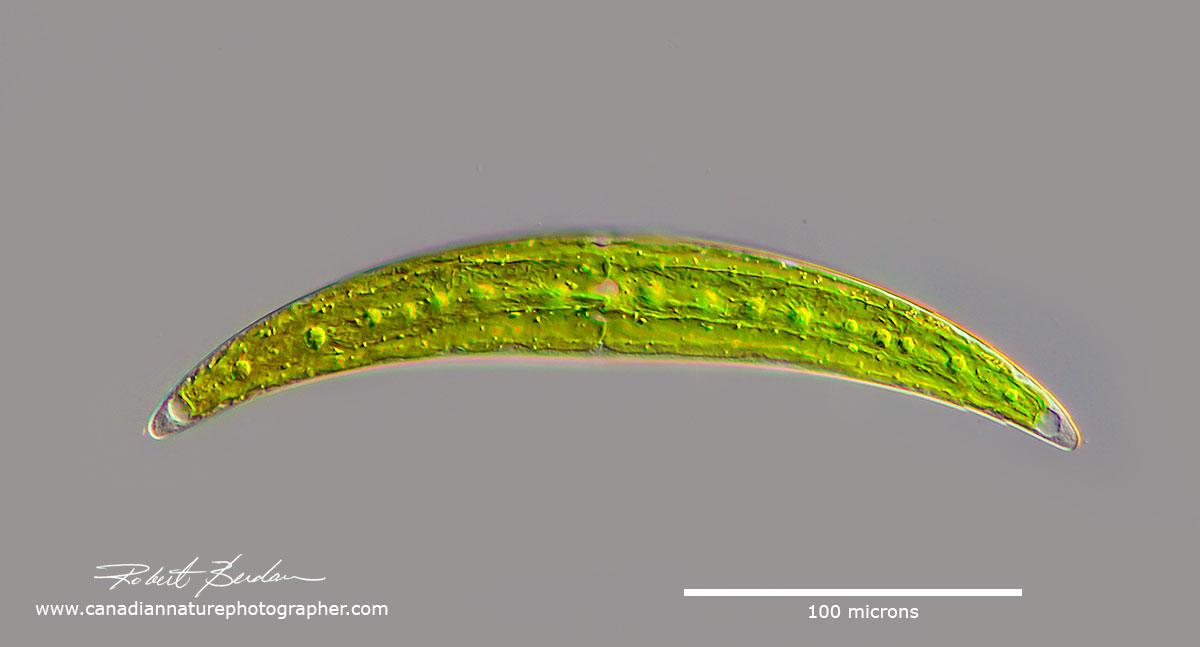 Closterium sp of Desmid Focus Stack DIC microscopy by Robert Berdan ©