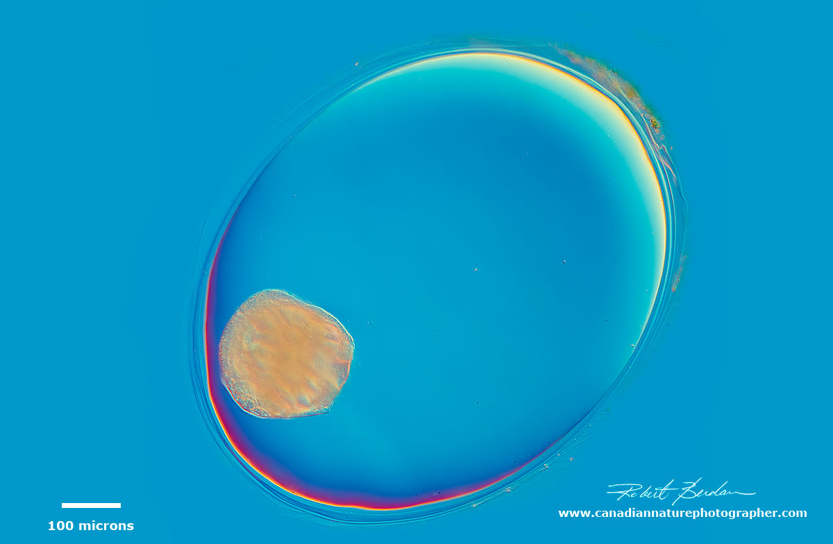 Freswater snail embryo - DIC microscopy by Robert Berdan ©
