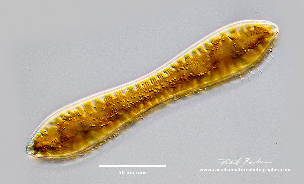 Cymatopleura solea diatom collected in pond water from Bowmount Park, Calgary Robert Berdan ©