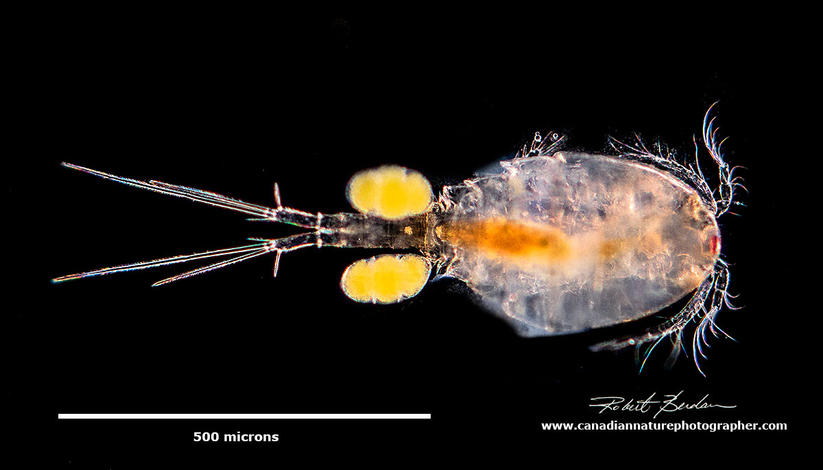 Copepod (also called Cyclops because of the single anterior eye). Darkfield microscopy by Robert Berdan ©