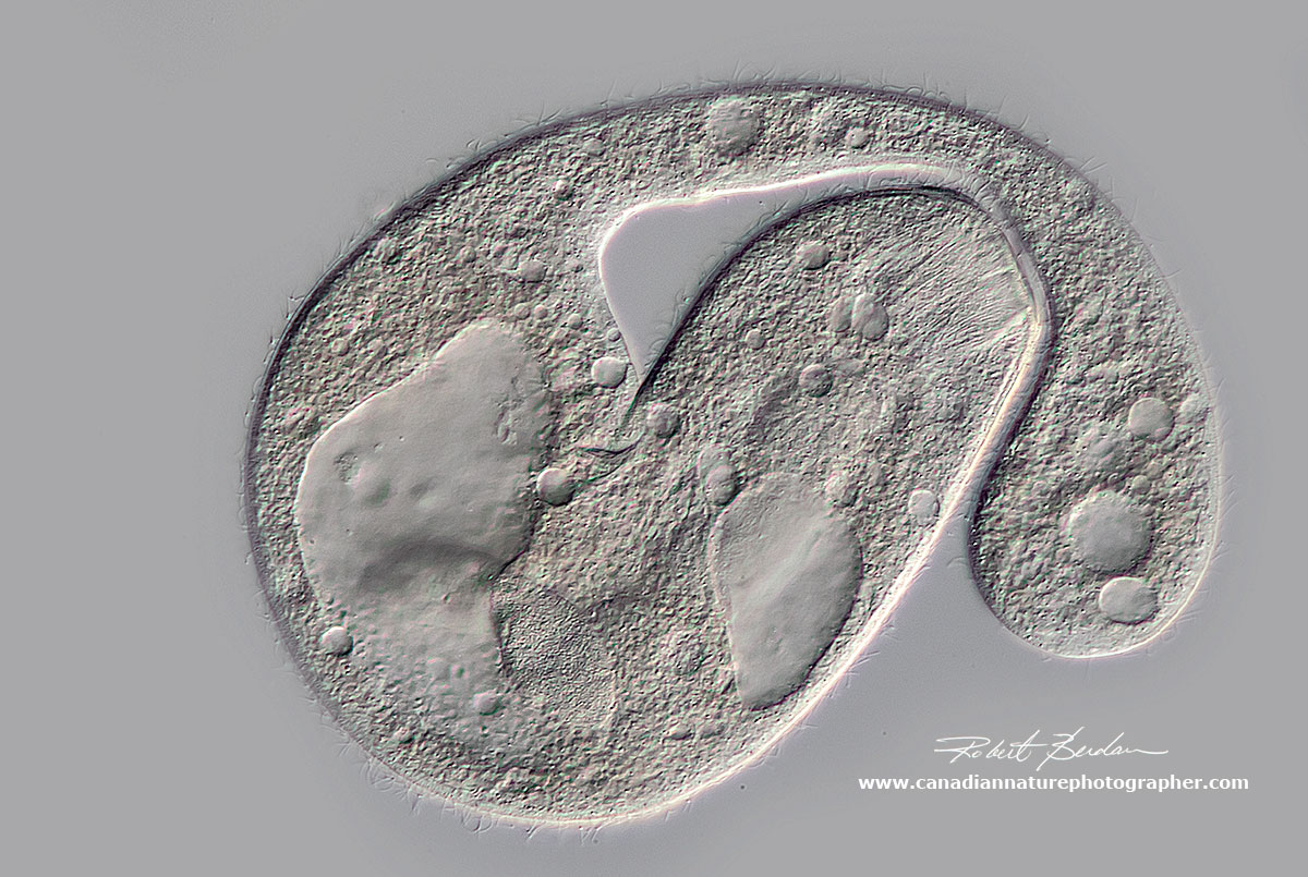 Possibly Holophyra  Ciliate by Robert Berdan ©
