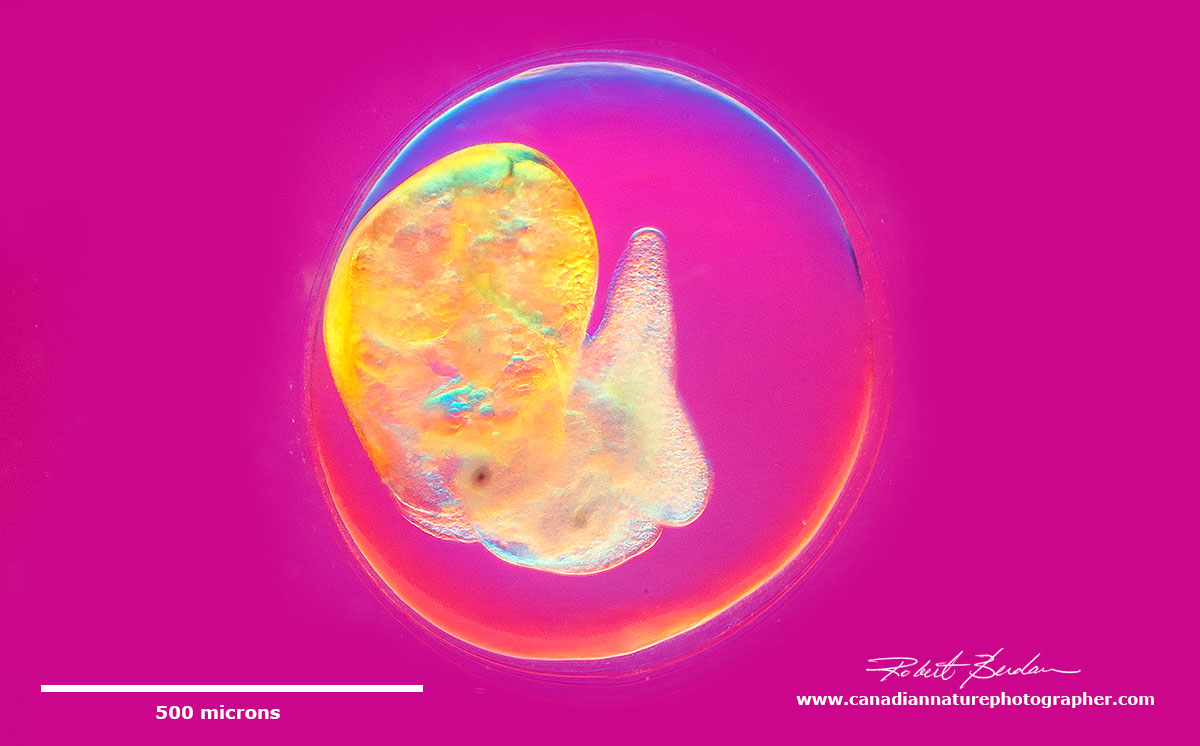 oung snail about to emerge from its egg - DIC microscopy by Robert Berdan ©