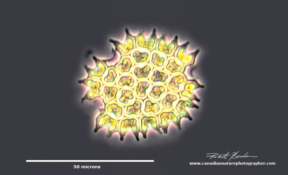 Pediastrum sp. is a genus of green algae. Phase contrast microscopy. by Robert Berdan ©