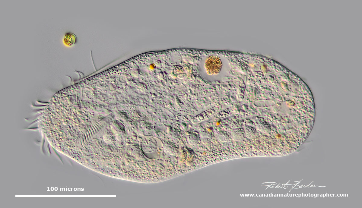 hypotrich might be a urostylid (e.g. Urostyla) by Robert Berdan ©