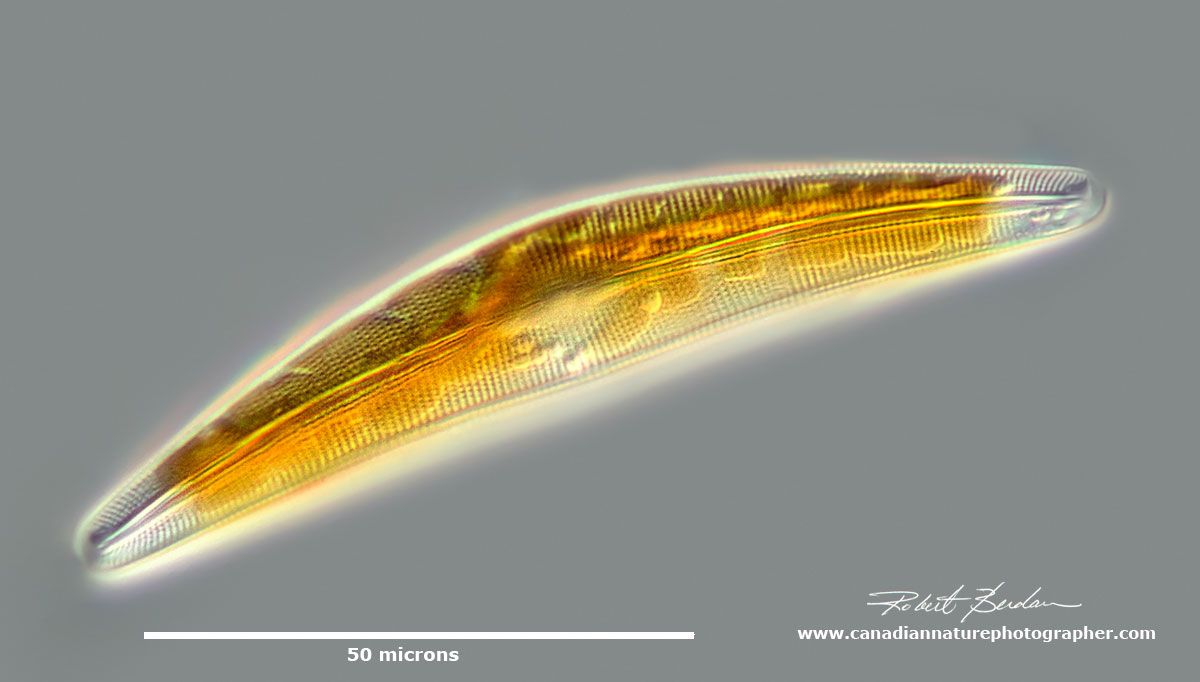 Cymbella sp Diatom DIC microscopy by Robert Berdan ©