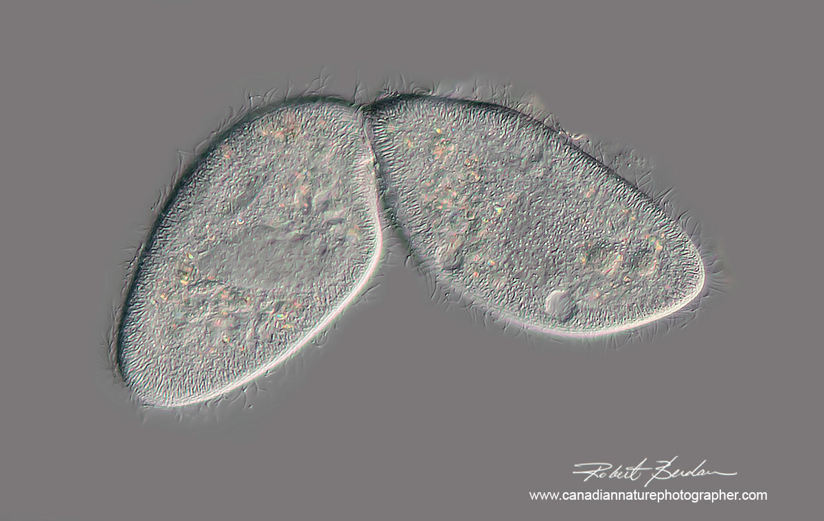 Two ciliates from pond water shown in the process of cell division. 400X DIC microscopy by Robert Berdan ©