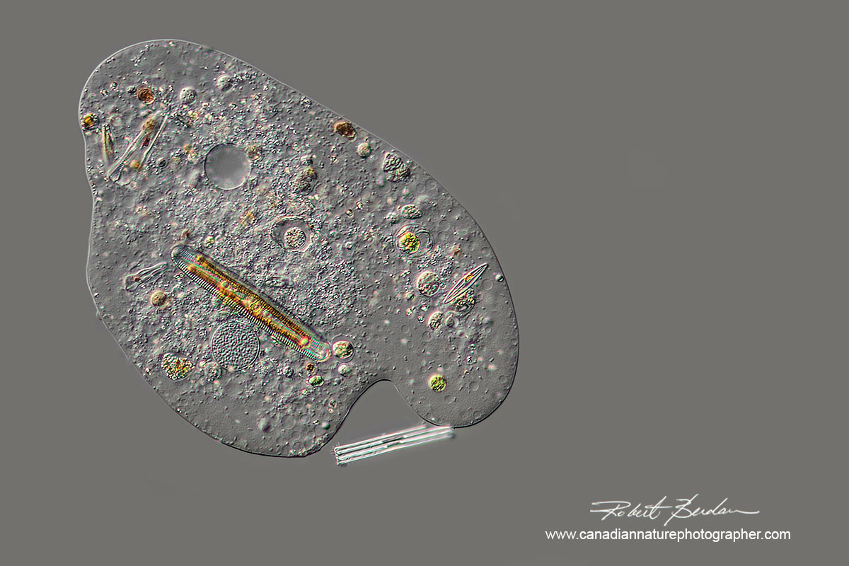 Amoeba viewed with Differential interference microscopy (DIC) with a diatoms inside  Robert Berdan ©