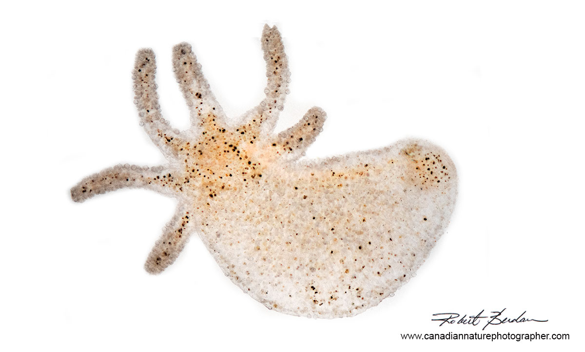 Hydra found in pond water viewed with bright field microscopy by Robert Berdan ©