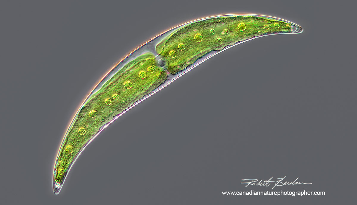 Closterium a single celled Desmid DIC microscopy Robert Berdan ©