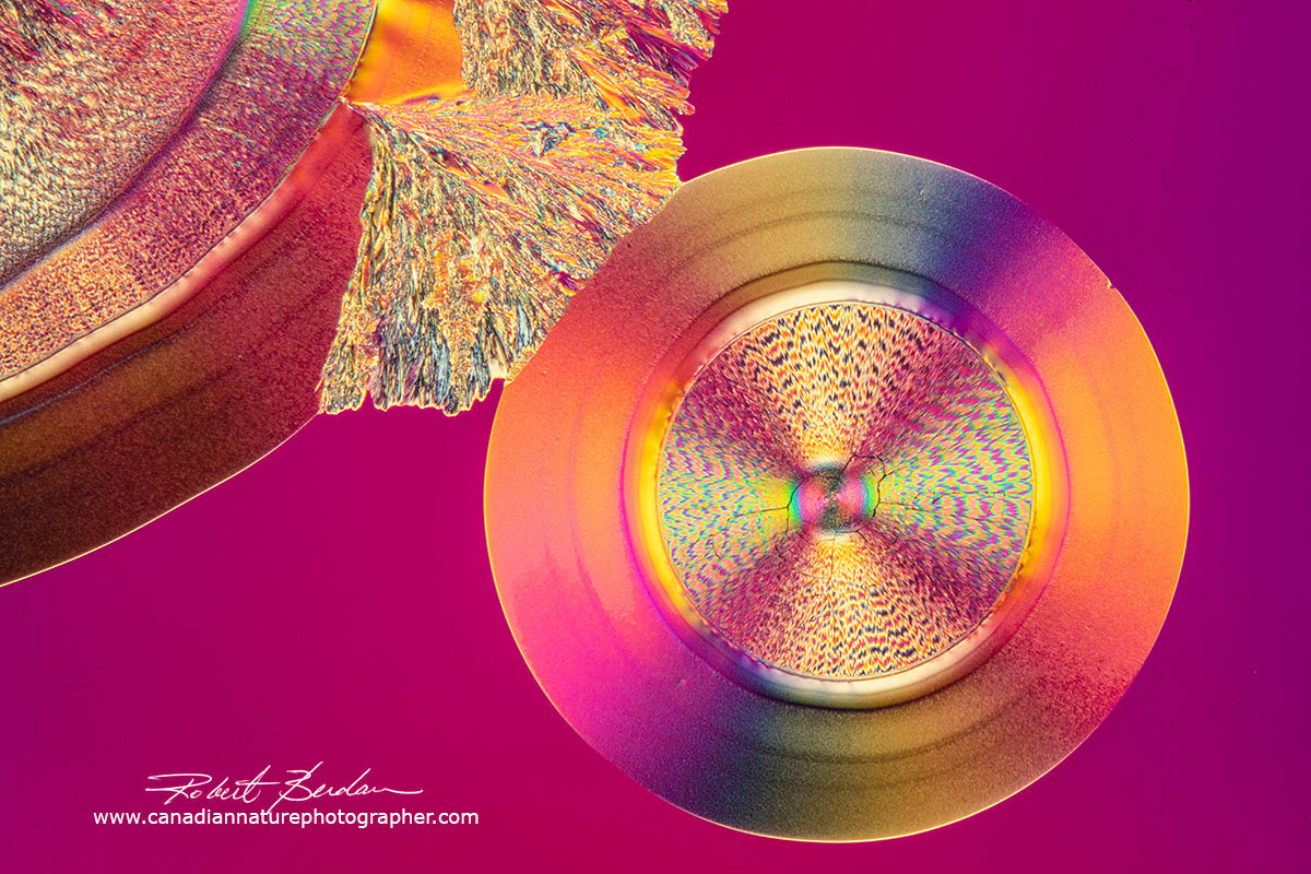 Polarized light microscopy showing Vitamin C crystals 100X Robert Berdan ©