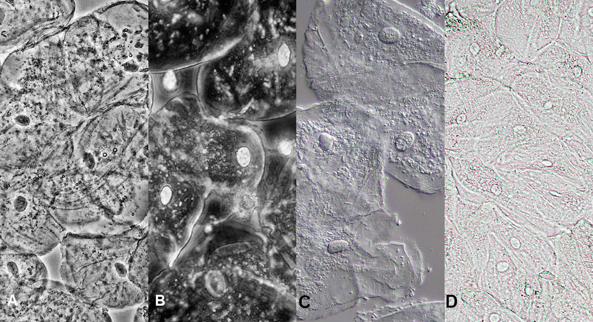 buccal epithelium viewed by phase contrast, brightfielf and differential interference microscopy Robert Bedan ©