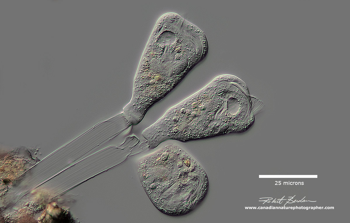Peritrich - Epistylis sp on broad flat stalk that is not contractile by Robert Berdan ©
