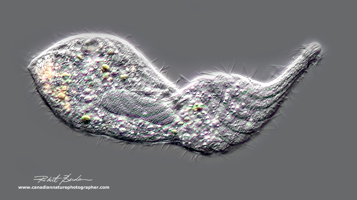 Lacrymaria olor DIC microscopy by Robert Berdan ©