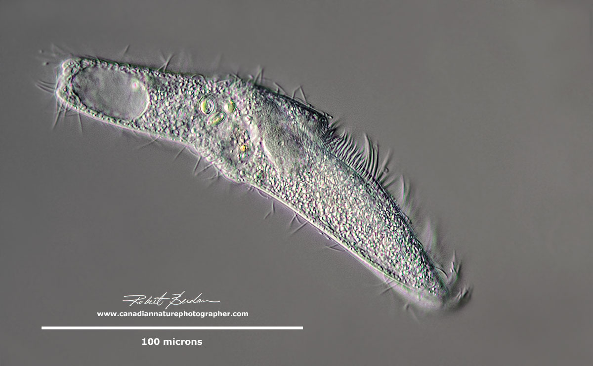Spirostomum minus in a contracted state by Robert Berdan ©