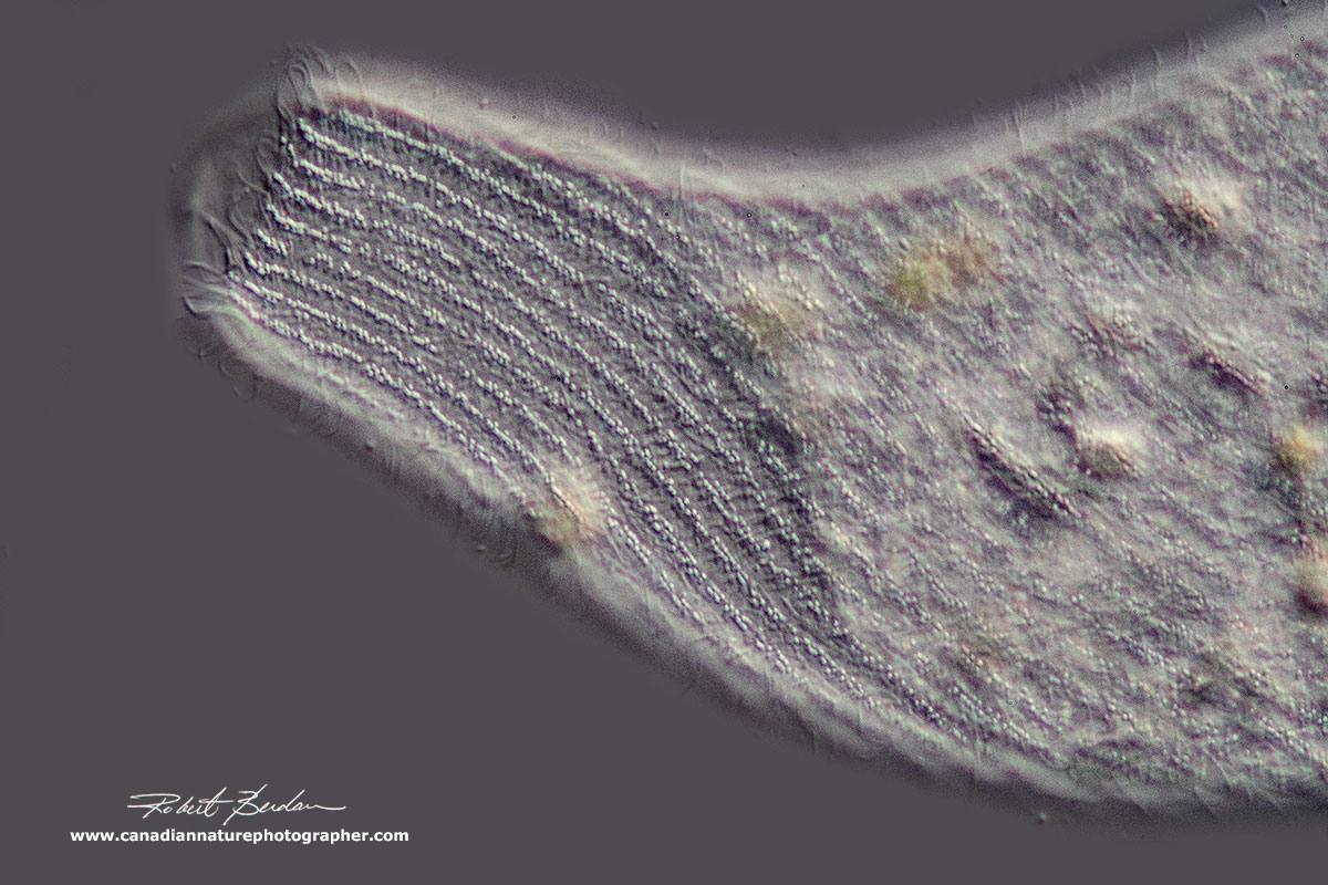 Spirostomum minus posterior end and contractile vacuole by Robert Berdan ©
