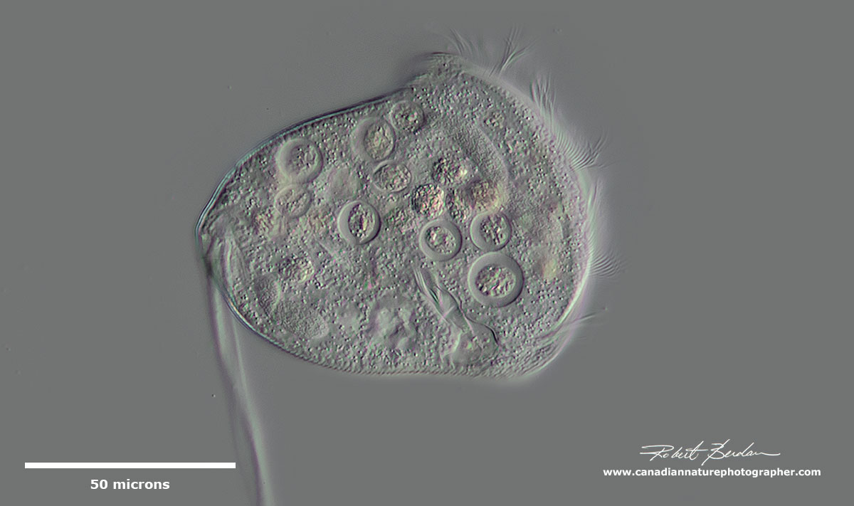 Vorticella or Pseudovorticella is a Peritrich ciliate by Robert Berdan ©