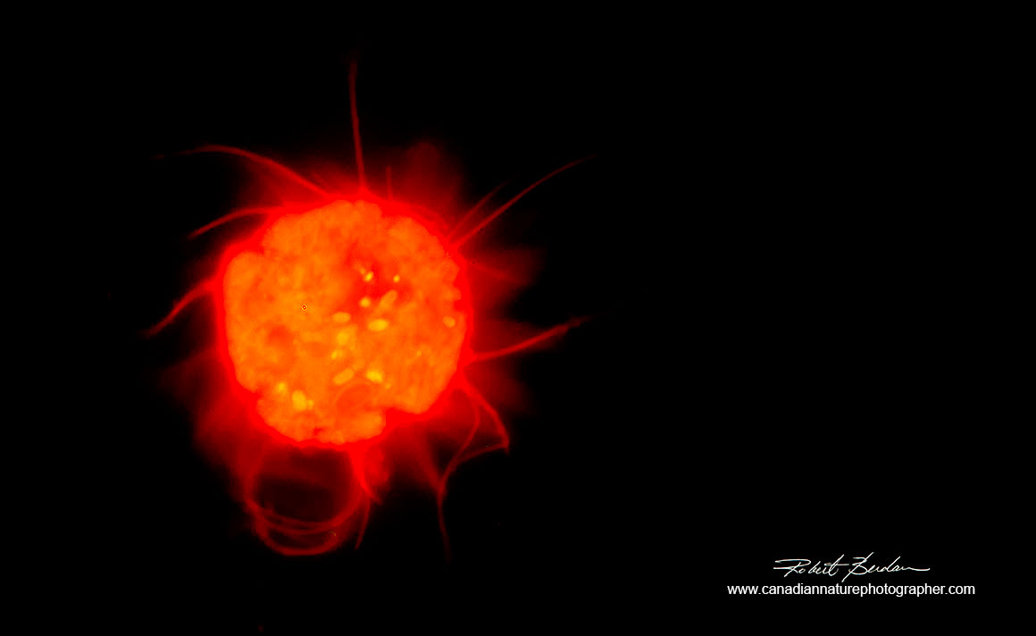 sun-like looking organism is a ciliate Halteria sp stained with Acridine orange 800X Flourescence microscopy Robert Berdan ©