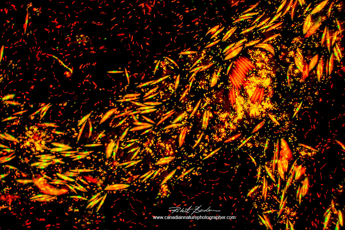 Bacteria red and algae orange with yellow nuclei (Elakatothrix viridis?) stained with Acridine orange 400X Fluorescence microscopy. Robert Berdan ©