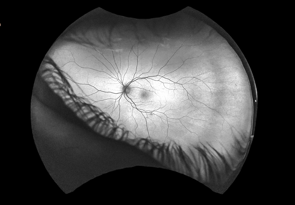 Flourescein angiograph of the back of eye  the Canadian Nature Photographer ©