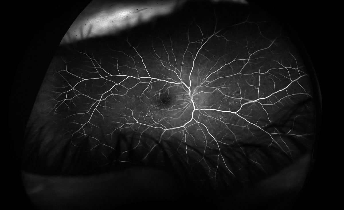 Image of my left eye showing Fluorescein in the branching blood vessels at the back of my retina - the Canadian Nature Photographer ©