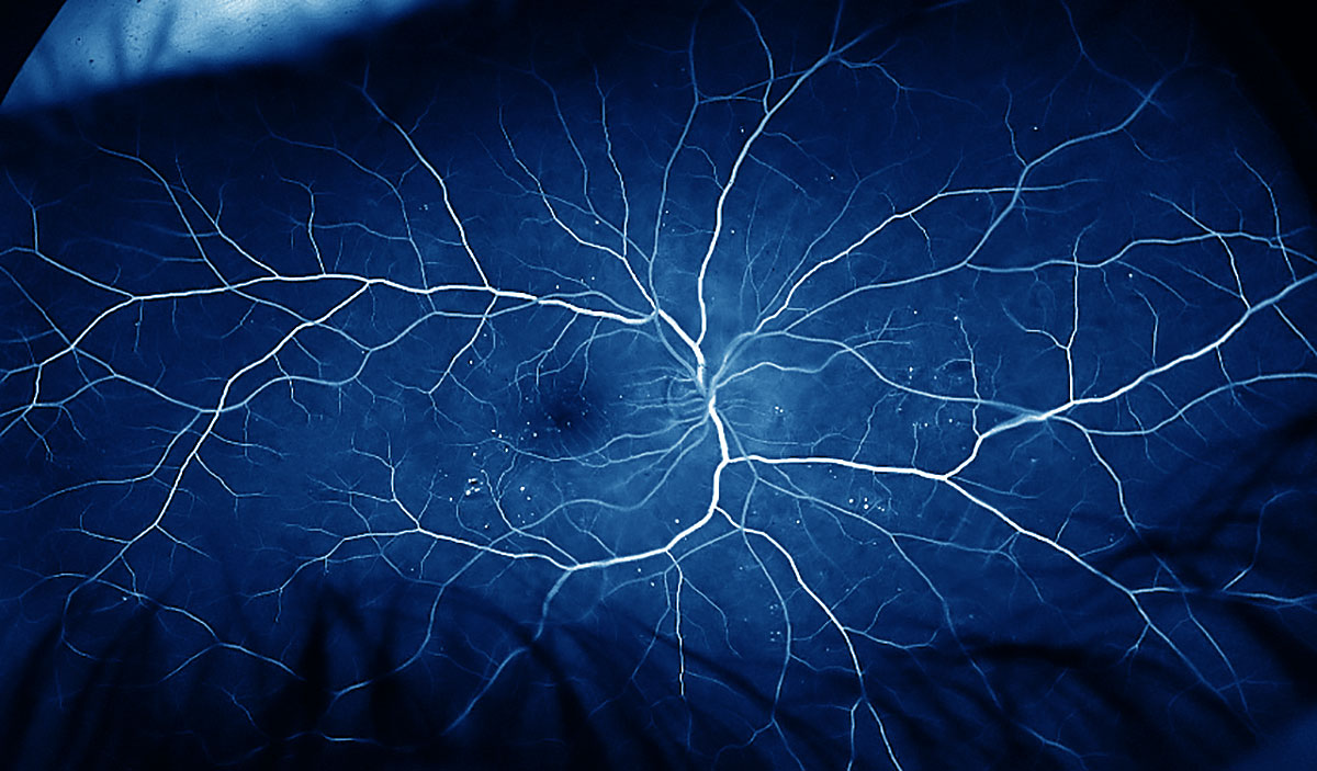 retina showing the blood vessels branching like a tree the Canadian Nature Photographer ©