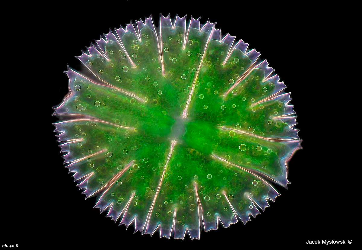 Desmid Micrasterias rotata, Darkfield Microscopy 400X by Jacek Myslowski ©