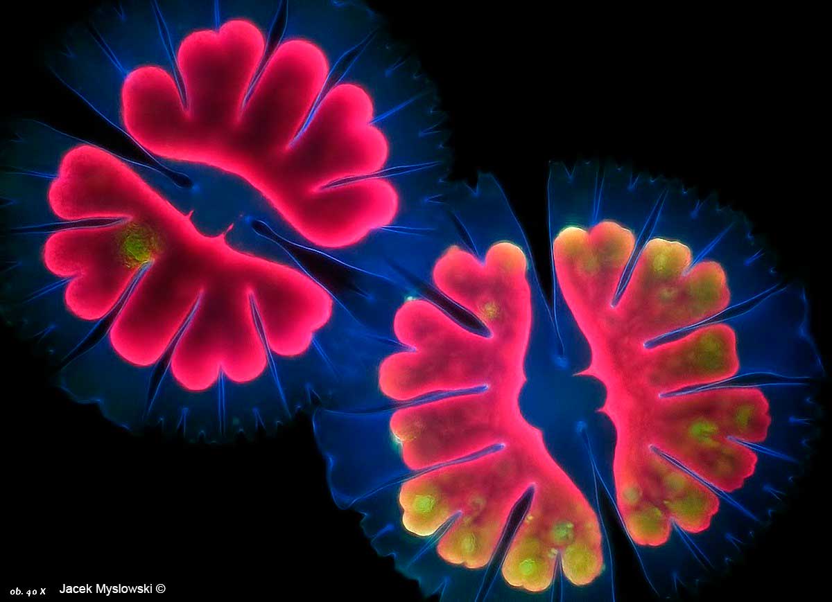 Desmid - Micrasterias thomasiana, Flourescence microscopy, 400X  by Jacek Myslowski ©