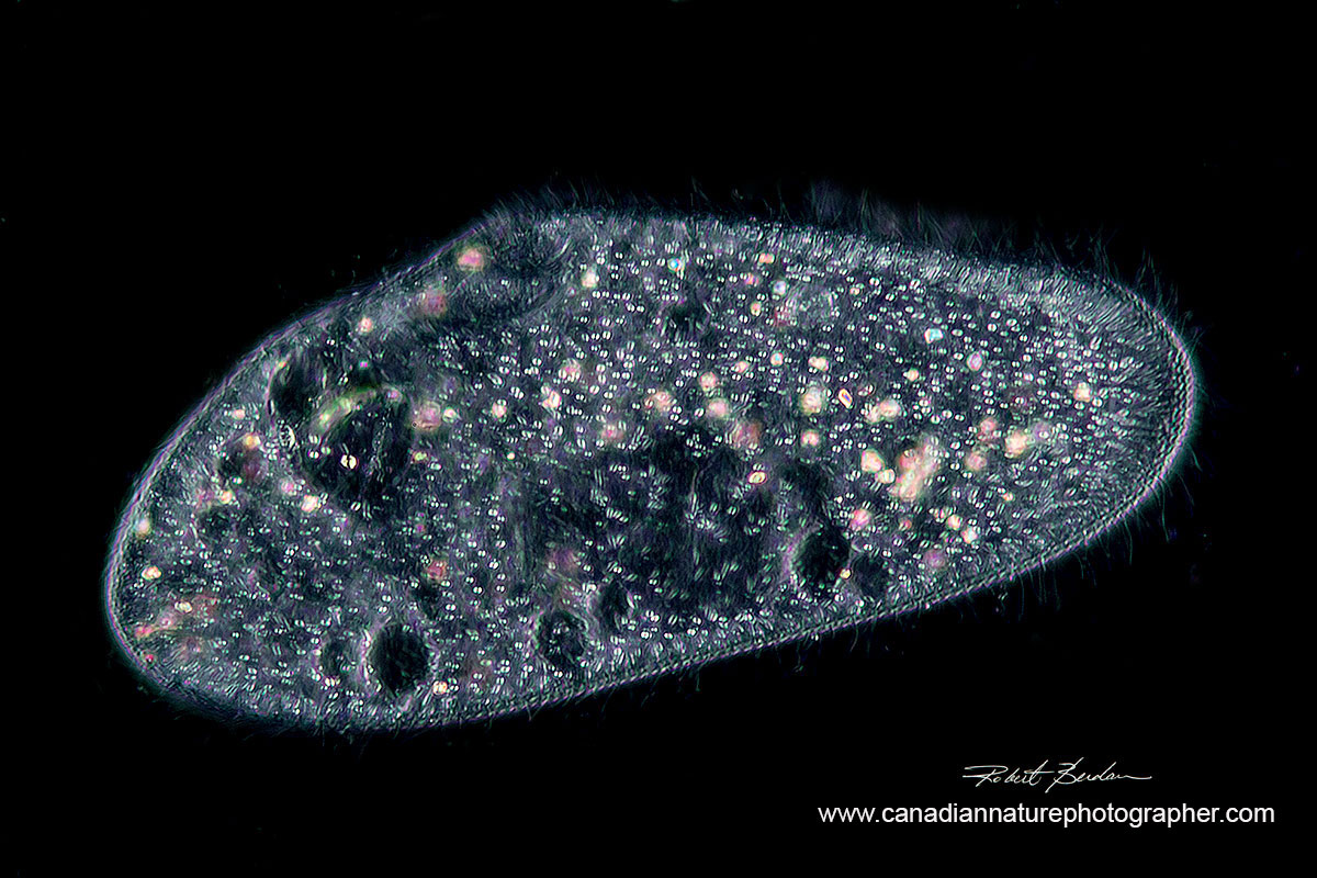 Paramecium caudatum photographed with Darkfield microscopy 400X by Robert Berdan ©