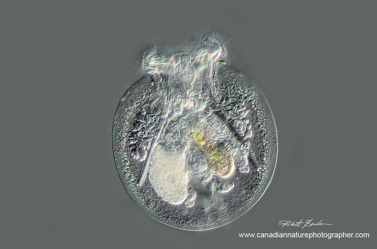 Rotifer Testudinella patina ventral view - 200X DIC microscopy - stack of 4 images by Robert Berdan ©