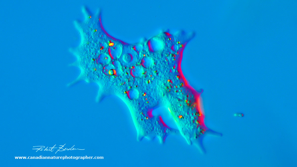 Amoeba 400X DIC microscopy by Robert Berdan ©