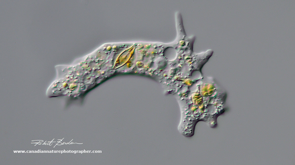 Amoeba with a diatom visible inside 400X DIC microscopy by Robert Berdan ©