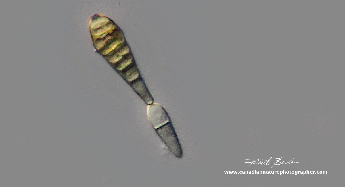 Meridion circulare Diatom valve view 400X DIC microscopy  by Robert Berdan ©