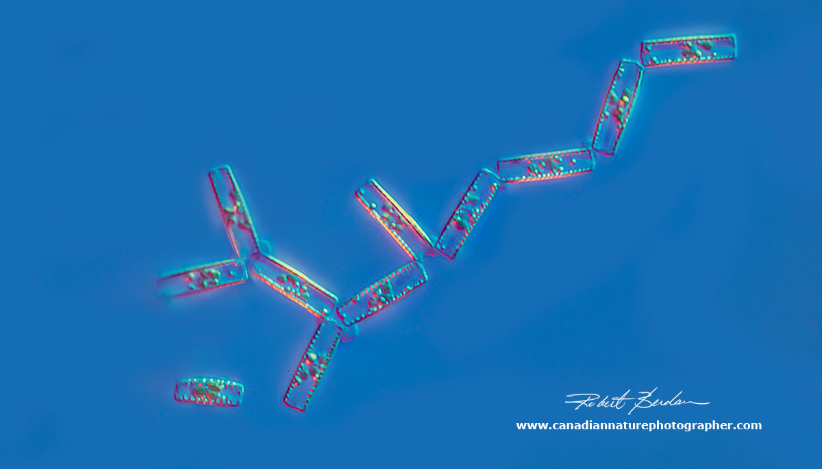 Tabellaria sp of Diatom forming a zig-zag chain - girdle view 400X DIC microscopy by Robert Berdan ©