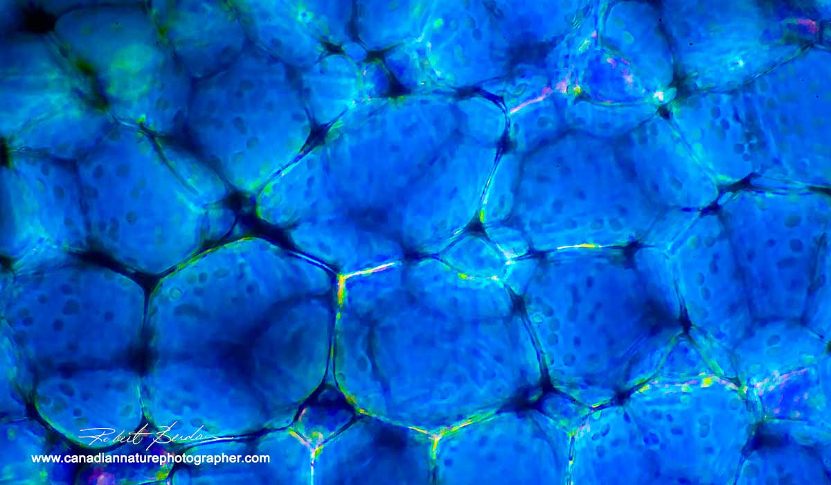 Bladderwort cells viewed in polarized light with a microscope by Robert Berdan 