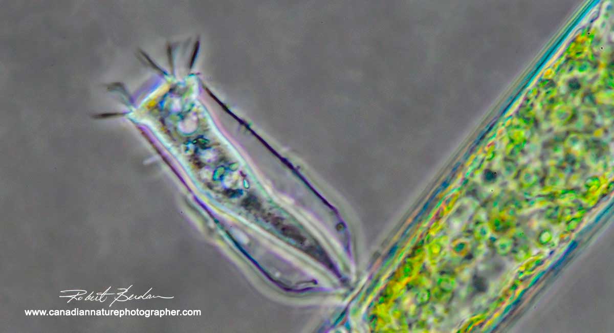 Ciliated Protozoan Thuricola foliculata that lives in a lorica  by Robert Berdan ©