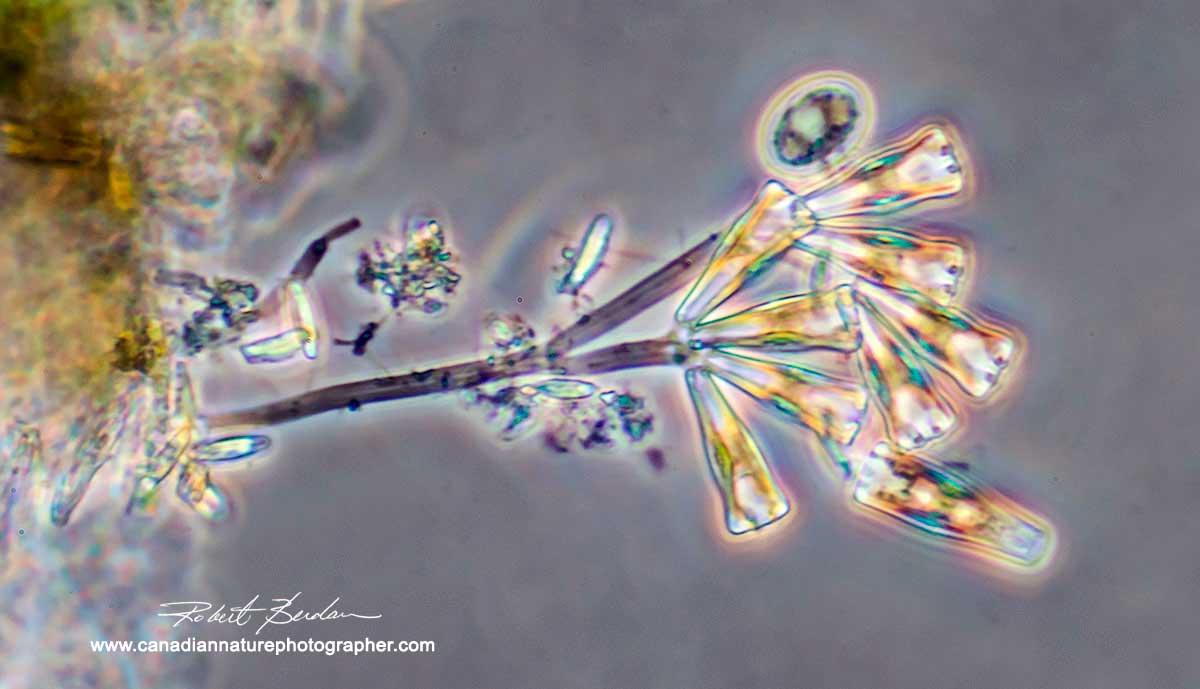 Diatoms (Didymosphenia geminata ) growing on a stalk attached to detritus, 400X Phase contrast microscopy Robert Berdan ©